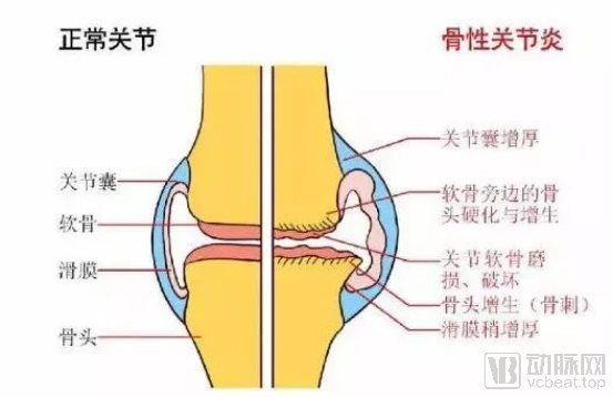 聚乙烯材料什么是聚乙烯材料？聚乙烯材料的最新报道(图4)